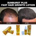 New Upgrade 100% Genuine Hair Growth Products Sunburst Plus Loção 100ml para crescimento capilar para rápida perda de cabelo